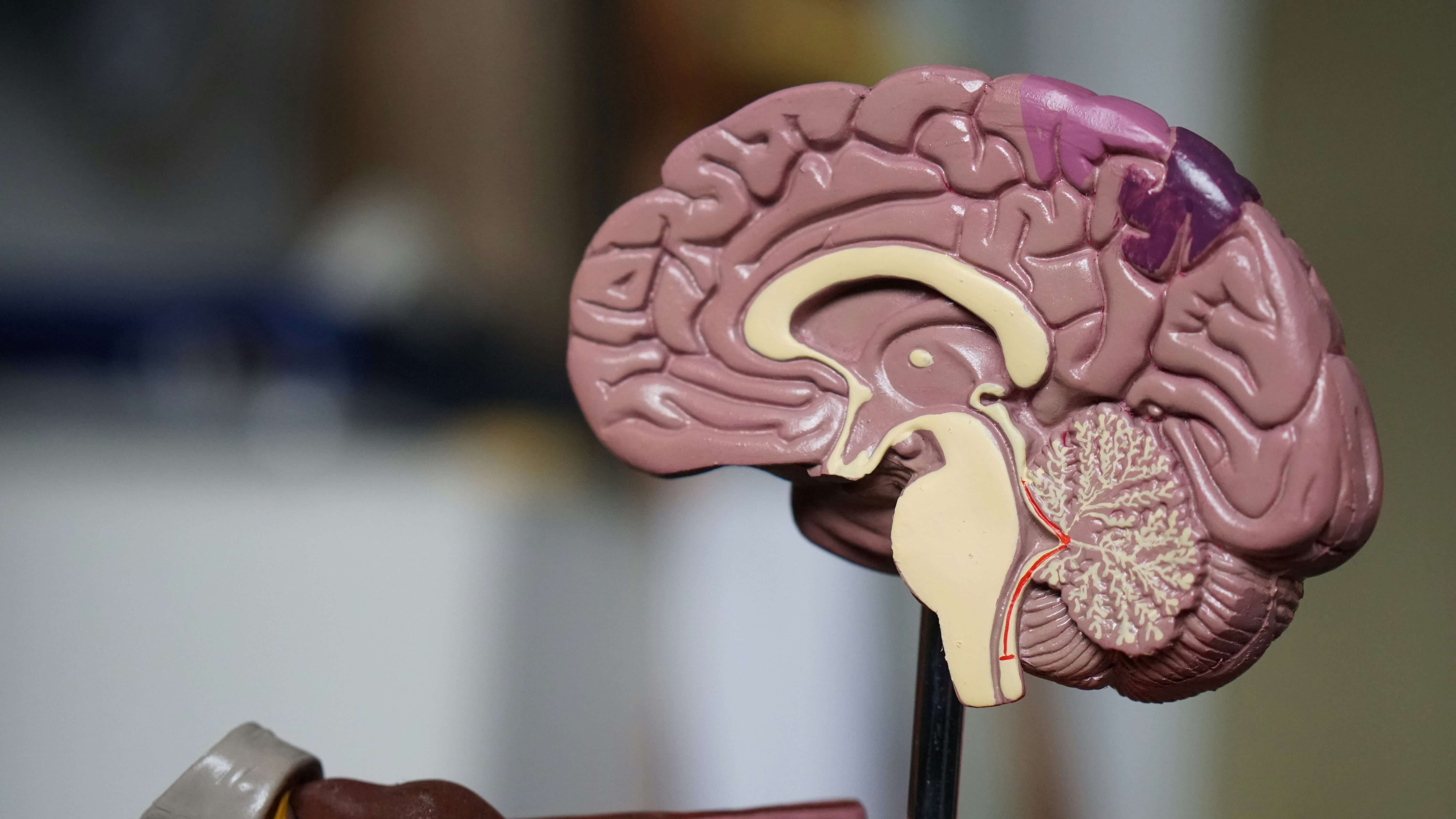 The Link Between Your Brain and Visceral Fat (1).jpg