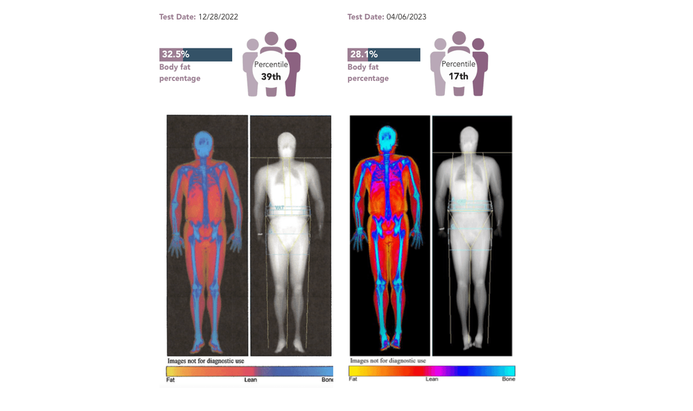 Netflix's “You Are What You Eat” Puts the DEXA Scan in the Spotlight ...
