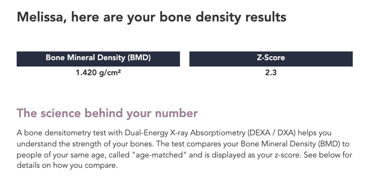 5 Facts About Bone Mineral Density | DEXA Scan Near Me. VO2 Max Near Me ...